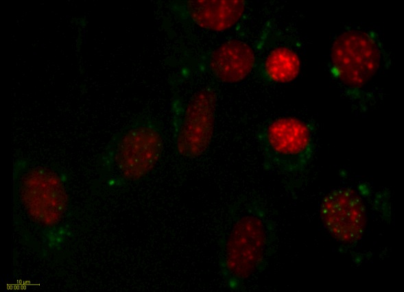 PML Movie 1: SK-N-SH transfected with PML. A field of SK-N-SH human neuroblastoma cells transfected with PML-DsRed (green) and counterstained with Hoechst to visualize the chromatin (red).