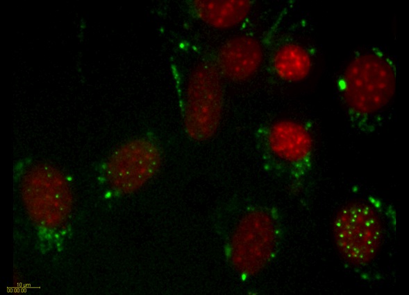 PML Movie 4: SK-N-SH transfected with PML. A field of SK-N-SH human neuroblastoma cells transfected with PML-DsRed (green) and counterstained with Hoechst to visualize the chromatin (red).