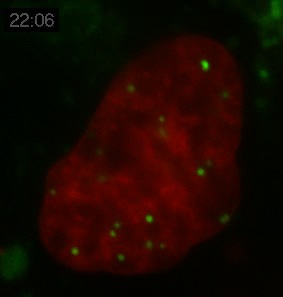 PML Movie 10: SK-N-SH transfected with PML. An SK-N-SH human neuroblastoma cells transfected with PML-DsRed (green) and counterstained with Hoechst to visualize the chromatin (red).
