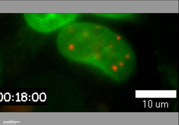 PML Movie 13: MCF-7 transfected with PML. MCF-7 breast cancer cells transfected with PML-DsRed (red) and counterstained with Hoechst to visualize the chromatin (green).