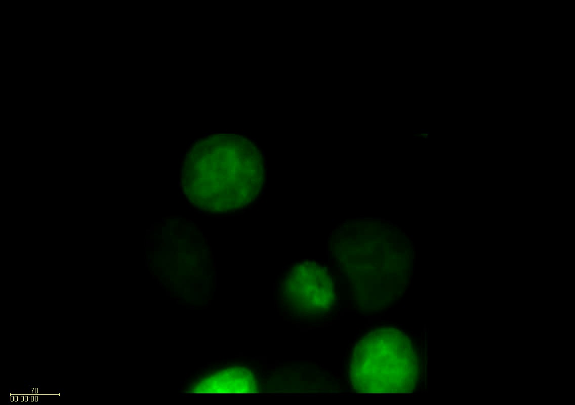 Mitosis Movie 1: A field of HeLa cells transfected with GFP-Histone H1.