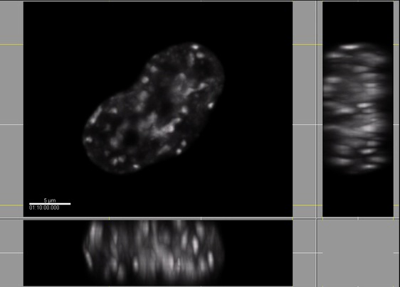 Mitosis Movie 4: An SK-N-SH cell entering mitosis. The cell was transfected with DsRed-Histone H1. XY, XZ, and YZ images are shown. The Z-scaling is preserved.