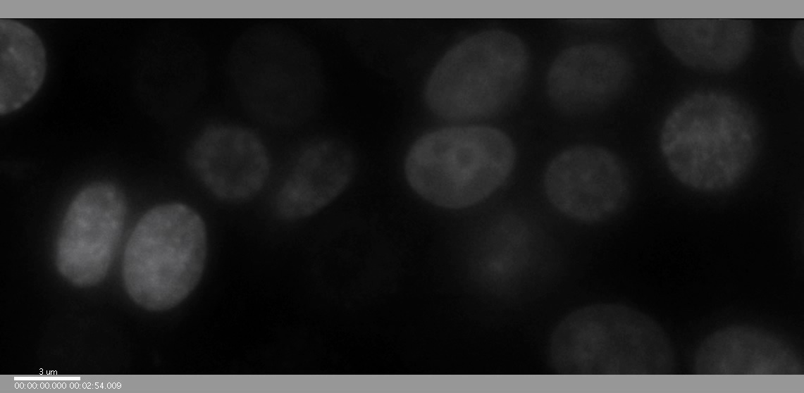 Mitosis Movie 9: A field of MCF-7 cells expressing DsRed-histone H1.