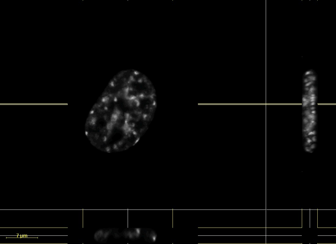 Chromatin Movie 1: An SK-N-SH cell transfected with DsRed-Histone H1. XY, XZ, and YZ images of a dataset deconvolved using Huygens (Scientific Volume Imaging) deconvolution software.