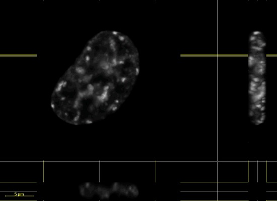 Chromatin Movie 2: The same cell as in Movie 1 in subsequent time ponts.