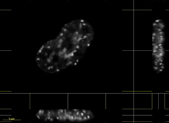 Chromatin Movie 3: The same cell as in Movies 1 and 2 in subsequent time points. 