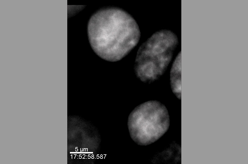 Chromatin Movie 6: HeLa cells expressing GFP-Histone H1. 