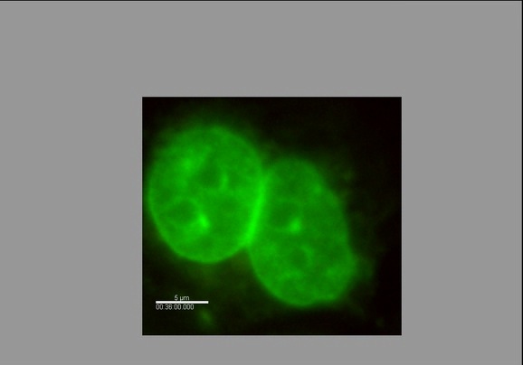 Chromatin Movie 12: MCF-7 cells stained with Hoechst